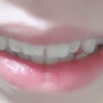 부정<b>교합</b> 심하지?ㅠㅠㅠ