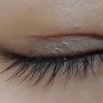 [조언부탁] 쌍수 1주일찬데 <b>속</b><b>쌍</b>될듯ㅜㅜ속상해