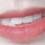 [댓글부탁해] 나 교정해야될거같아?ㅠ <b>사진O</b>
