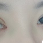 <b>쌍수</b> 붓기 ㅇㄸ