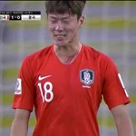 [드루와] 짱깨새끼 목에 <b>상처</b>낸거봐봐 __