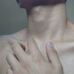 [19] 이 <b>쇄골</b>올린 쓴이 들어와봐