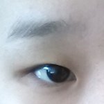 [드루와] 잠 안 와서 쓰는 <b>쌍수</b>+앞트임 후기