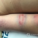 태권도 코치가 여중생 <b>무자비</b> 폭행 중상 분노확산