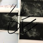 [EXO] <b>태교</b>할때 보려고 하는데 예쁜 아기 사진 있으면 좀 줄래...