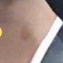 얘들아 이거 키스마크야?