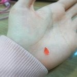 [드루와] <b>입술각질</b>