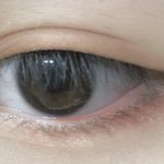 [조언부탁해] <b>쌍수</b> 할까말까