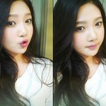 하이랭커 <b>박수영</b>