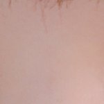 쌍수 <b>절개</b> 17일차인데