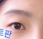 무쌍 쌍수 시급하냐??