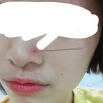 [댓글부탁해] 코피어싱 <b>셀프</b>로 뚫는중