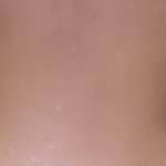 [댓글부탁해] 나 쌍수 했는데ㅠㅠ