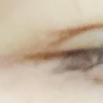 쌍수했는데 쌍꺼풀<b>두</b>개가 이렇게 <b>두겹</b>이야ㅠㅠㅠ 이거뭘까