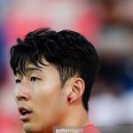 [ㅈㄱㄴ] 오늘자 손흥민 부상 <b>투혼</b>