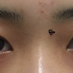 [조언부탁해] 나 눈 무슨성형을 해야할까