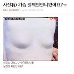 나 기슴성형 할까말까