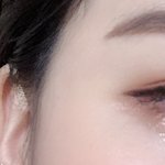 [ㅈㄱㄴ] <b>쌍수</b> <b>티</b> 많이 나냐