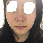 [댓글부탁해] (사진)코 크고 얼굴 형 땜 스트레스야 <b>쉐딩</b>범좀