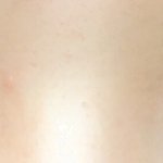 [댓글부탁해] <b>쌍수</b> 망한 후기 볼사람