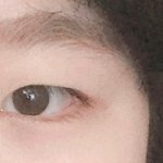 <b>쌍수</b> 이 정도면 성공 케이스 아니냐