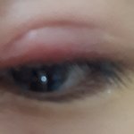 [댓글부탁해] 나 지금 다래끼 짱<b>심해</b>..