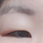 <b>쌍수</b>후기