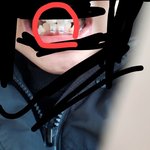 [조언부탁해] 교정하는애들아 알려줘...
