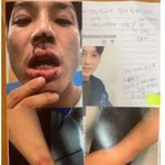 [드루와] 이거 제발 꼭읽어줘 <b>승리</b> 클럽 피해자글이야