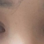 나 얼마뒤에 학겨가는데 쌍수 티<b>낭</b>?ㅠ