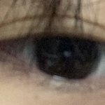 제 눈이 <b>동태눈</b>인가요?