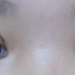 쌍수했는데 망한<b>거가</b>타...ㅜㅜ