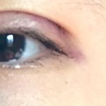 [드루와] (<b>맨밑</b>에 사진있음 혐ㄴㄴ) 어제 쌍수한 후기