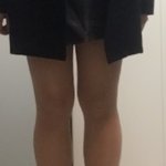 [이것좀봐줘] 종아리 스트레칭 사진 <b>전후</b> 비교!̆̈ !̆̈