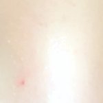 [이것좀봐줘] 쌍수 라인 짝짝이때메 우울증