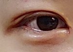 [댓글부탁해] <b>쌍수</b> 붓기빠져도 <b>라인</b> 내려오나요?