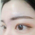 [댓글부탁해] 열어분~~^^ 쌍수 한달차<b>임당</b>~~~^^