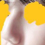 코 메<b>부리</b> 심함?
