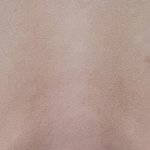 안검<b>하수</b> 심하면 쌍수각이야 ? 사짐 있음