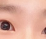 얘들아 나 뒤트임할까