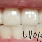 나 <b>치열</b> 교정 안 한 거 치고는