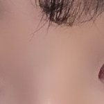 나 쌍수 <b>이주</b>뒤에 하는데ㅠㅠㅠ