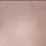 [댓글부탁해] 쌍수 망한걸까..?