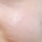 [댓글부탁해] 모공이 계속 있어나고 있어ㅜㅜ