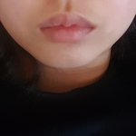 교정하면 <b>입모양</b> 예뻐짐?