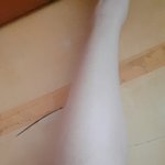 [드루와] (혐주의)다리 알 어떡해 제발 살려줘ㅜㅜㅜ