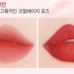 나처럼 심한 <b>속쌍</b>있냐