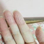 나 손ㅈㄴ<b>건조</b>함