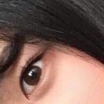 [조언부탁] 애들아 나 도와줘 유통기한 지난 선크림 쓰고 난 뒤부터...