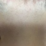 나 쌍수 어때